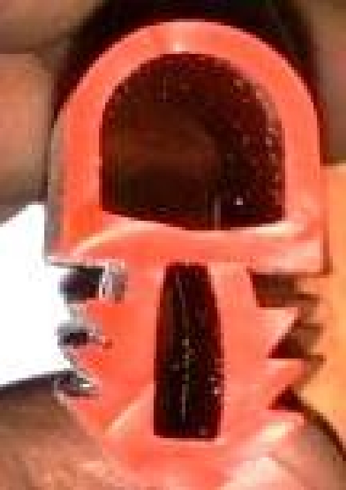 CONTA-ENDÜSTRİYEL PROFİL